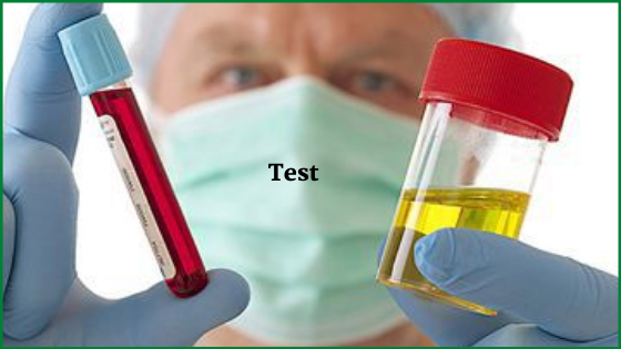Hematuria Test | Hematuria Treatment in Bellandur