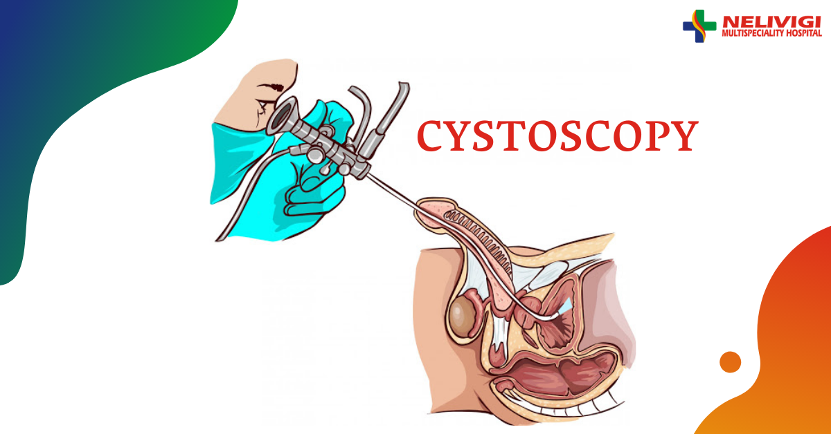 Cystoscopy Treatment in Bangalore